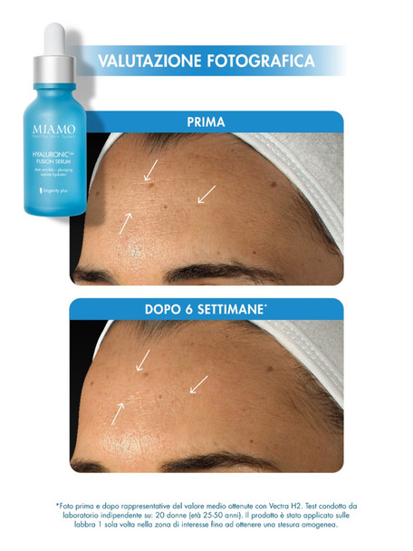 Miamo - Protocollo Plump&Fill Per Rughe Di Disidratazione