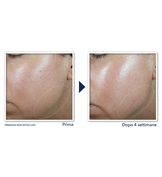 Roc - Derm Correxion Crema Viso e Collo Retinolo Confezione 50 Ml