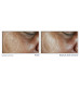 Roc - Multi Correxion Crema Viso Idratante Antimacchie Spf30 Confezione 50 Ml