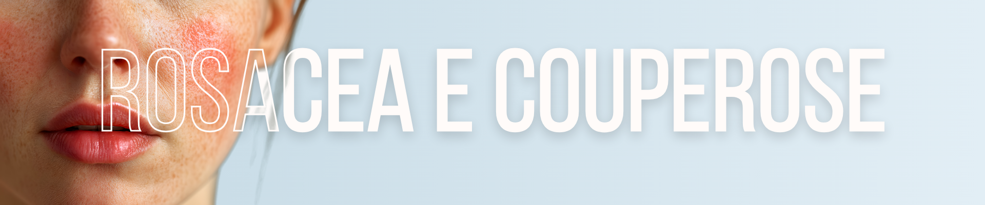 Prodotti per rosacea e couperose: creme e sieri lenitivi anti-rossore