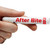 Adventure Medical After Bite Itch Relief Pen 0.5oz - Quick Mosquito and Bug Bite Relief