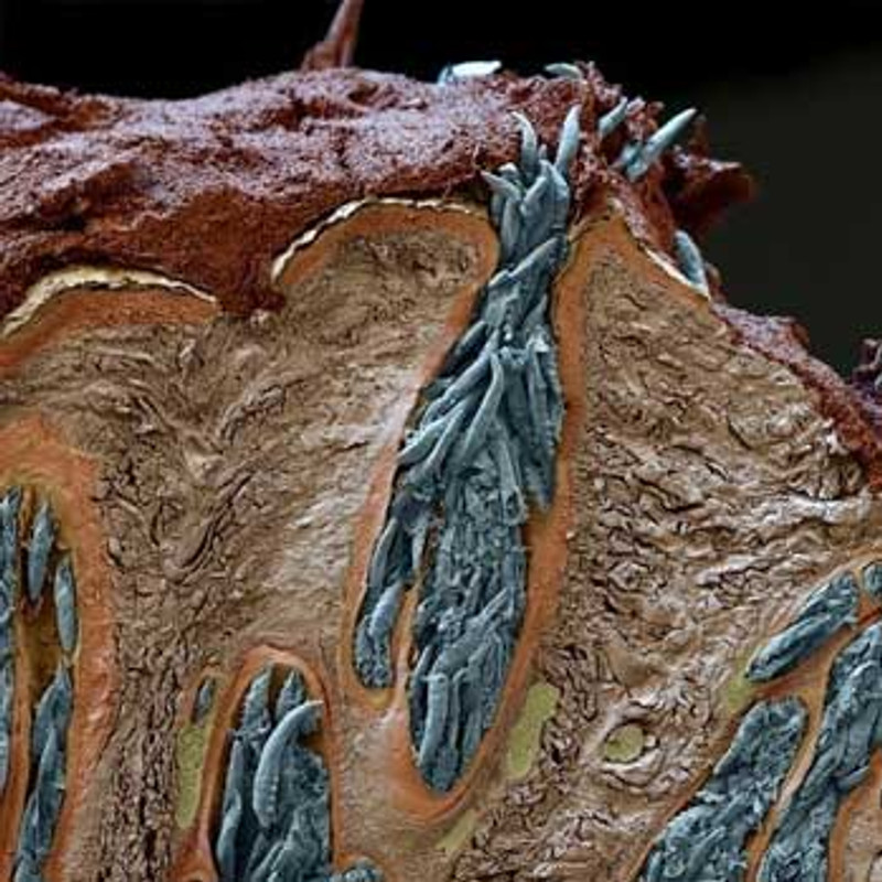 Holy Mites! What's living inside your pores!