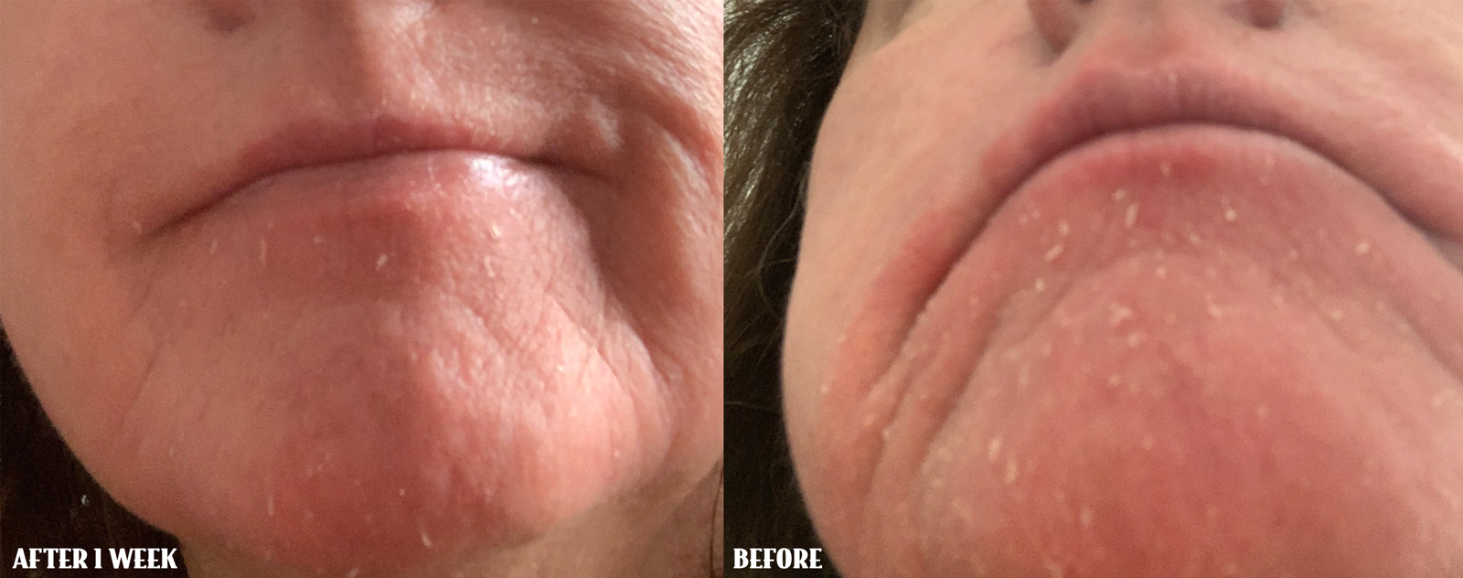 Teresa Emu Oil Teresa Emu Oil