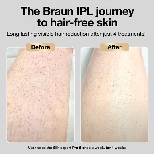 Braun IPL, Silk·expert Pro 5, PL5157