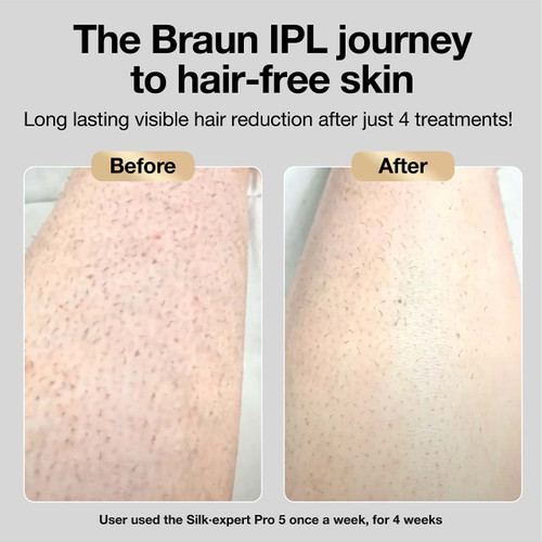 Braun Silk Expert Pro5 IPL Hair Removal Device for Romania