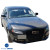 Carbon Fiber VVV Hood > Audi A4 (B8) 2009-2012 - image 4
