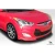 2012-2015 Hyundai Veloster Non Turbo N Design Body Kit - 3 Piece - image 6
