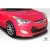 2012-2015 Hyundai Veloster N Design Kit - image 7