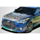 2012-2017 Hyundai Veloster AM-S Carbon Fiber Hood - image 1