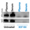 XCF Exosomal DNA Isolation Kit