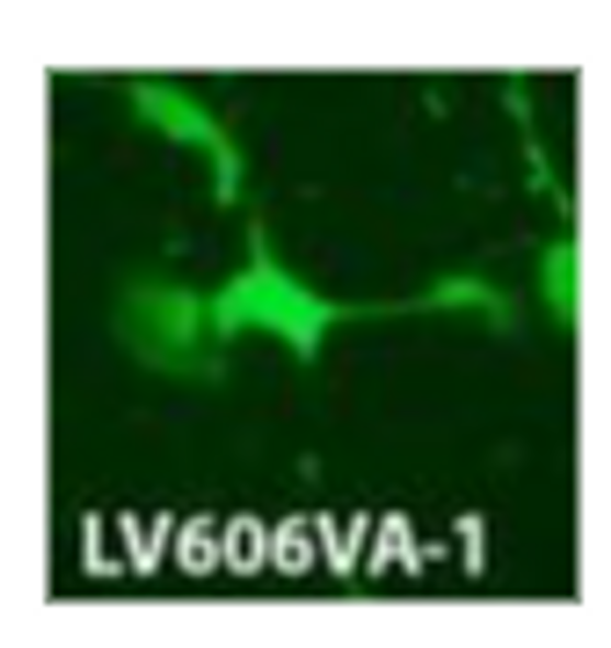 pPS-UBC-GFP-RFP (plasmid)