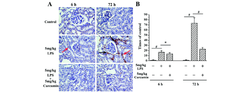 a-representative-immunohistochemical-slides-for-f4-80-a-surface-marker-of-macrophages.png