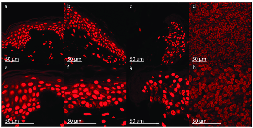 propidium-iodide-pi-staining-in-human-full-thickness-skin-graft-cross-sections-no.png