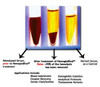 HemogloBind™ Hemoglobin Depletion From Hemolyzed Serum/Plasma