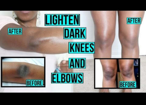 SKIN GLOW( Scan discoloration cream)