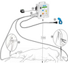 High Frequency Immobilization & Bleed Stimulator