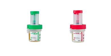 Allergen Testing in Food Manufacturing: Methods and Regulatory Requirements