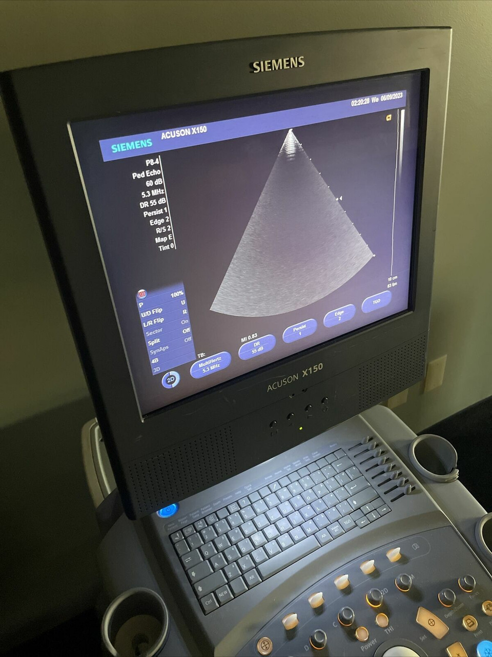 Ultrasounds