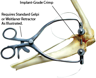 Product VOI Cruciate Tension Clamp | J0710R Image