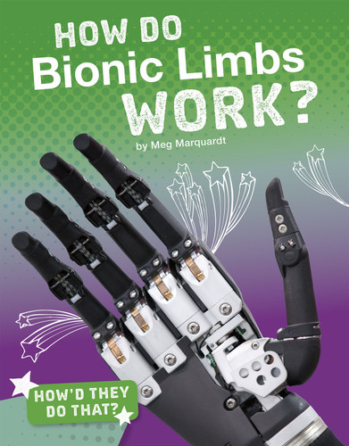 How Do Bionic Limbs Work? by Meg Marquardt, 9781543541373