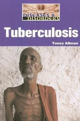 Tuberculosis - 9781590189689 by Toney Allman, 9781590189689