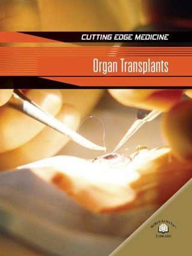 Organ Transplants by Carol Ballard, 9780836878684 Organ Transplants by Carol Ballard, 9780836878684