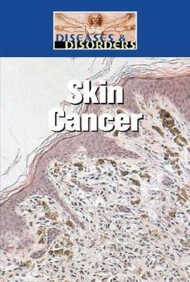 Skin Cancer - 9781590189313 by Bonnie Juettner, 9781590189313