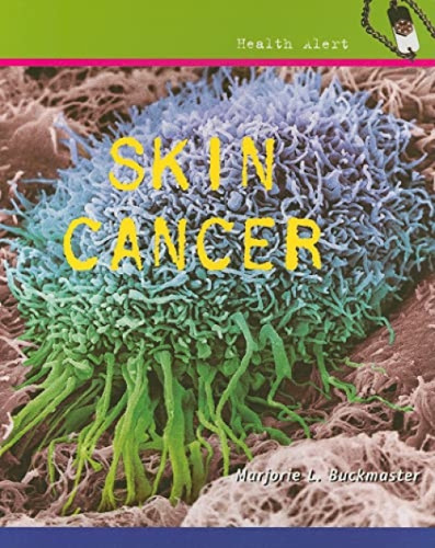 Skin Cancer - 9780761427032 by Marjorie L. Buckmaster