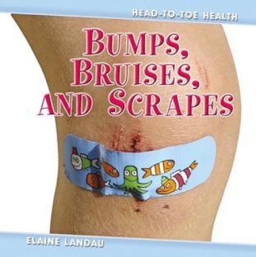 Bumps, Bruises, and Scrapes by Elaine Landau, 9780761428497