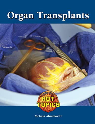 Organ Transplants - 9781420508161 by Melissa Abramovitz