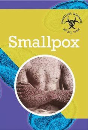 Smallpox - 9781502600844 by Lawrence Andrews, 9781502600844