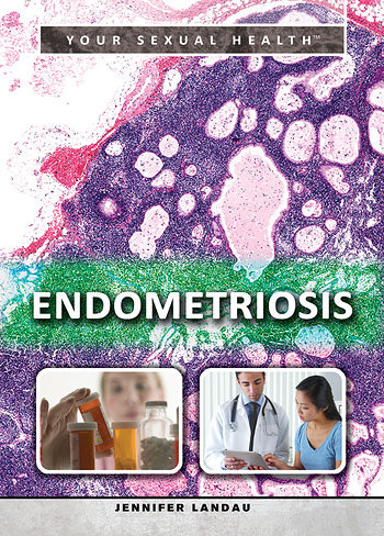 Endometriosis - 9781499460742 by Jennifer Landau, 9781499460742