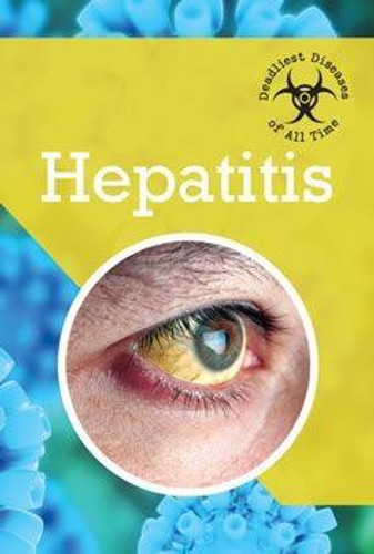 Hepatitis - 9781502606501 by Petra Miller, 9781502606501