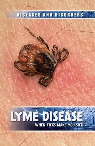 Lyme Disease (When Ticks Make You Sick) by Raymond J. Lampke, 9781534563629 Lyme Disease (When Ticks Make You Sick) by Raymond J. Lampke, 9781534563629