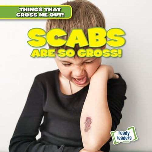 Scabs Are So Gross! - 9781482471458 by Lynda Arnez, 9781482471458