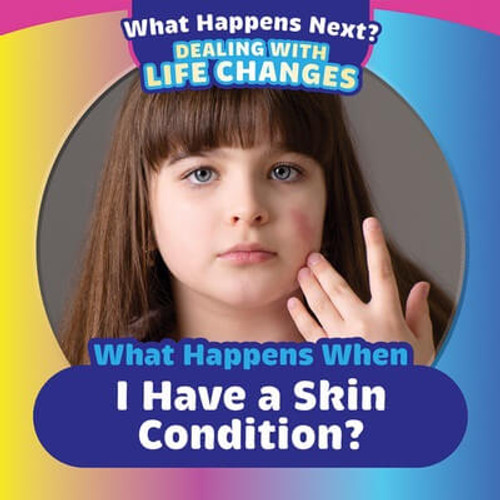What Happens When I Have a Skin Condition? - 9781499452648 by Emiliya King, 9781499452648