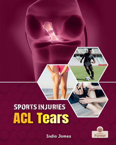 ACL Tears by India James, 9781039880795