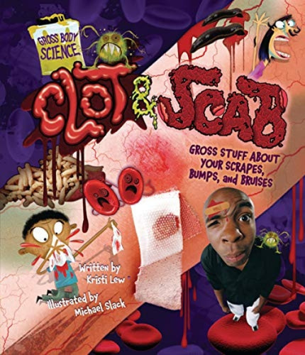 Clot & Scab (Gross Stuff about Your Scrapes, Bumps, and Bruises) by Kristi Lew, Michael Slack, 9781541500853
