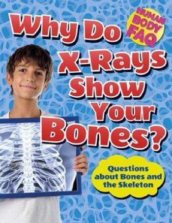 Why Do X-Rays Show Your Bones? (Questions About Bones and the Skeleton) by Thomas Canavan, 9781499431735