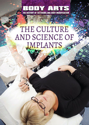 The Culture and Science of Implants by Monique Vescia, 9781508180654