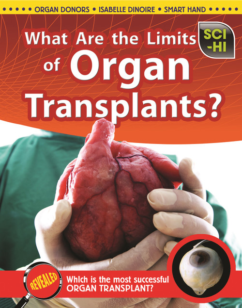 What Are the Limits of Organ Transplants? by Anna Claybourne, 9781410944665