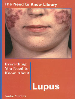 Everything You Need to Know About Lupus by André Maraux, 9780823932887