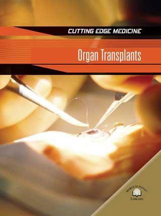 Organ Transplants by Carol Ballard, 9780836878684