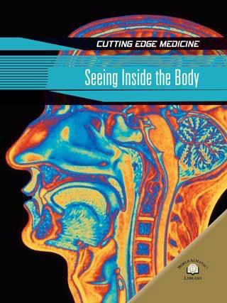 Seeing Inside the Body by Andrew Solway, 9780836878691
