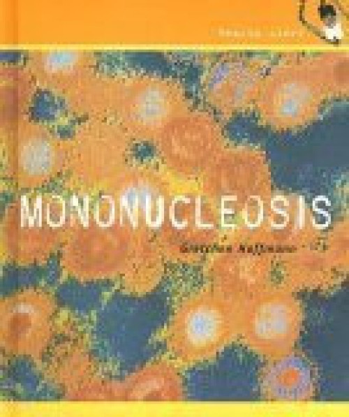 Mononucleosis by Gretchen Hoffmann, 9780761419150