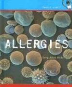 Allergies by Terry Allan Hicks, 9780761419181