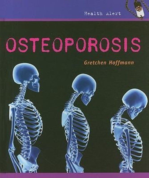 Osteoporosis by Gretchen Hoffmann, 9780761427025