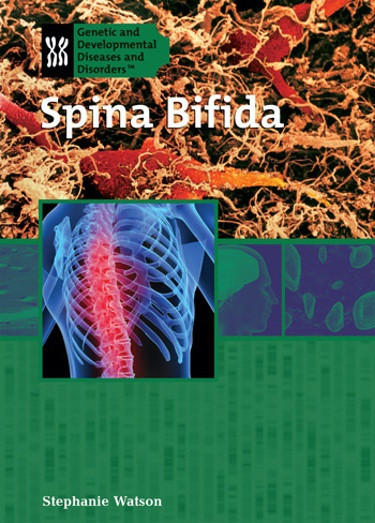 Spina Bifida by Stephanie Watson, 9781404218536