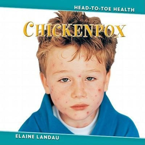 Chickenpox by Elaine Landau, 9780761434986