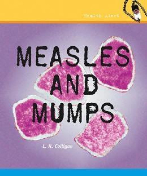 Measles and Mumps by L. H. Colligan, 9780761448198